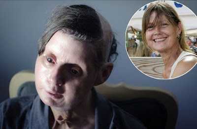 Βελτίωση εγκαταστάσεων στα γήπεδα Κωστακιών, Γραμμενίτσας και Καλοβάτου από το Δήμο Αρταίων