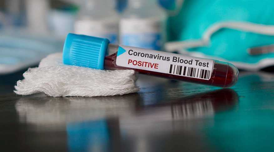 Στα 10 ανέρχονται τα νέα κρούσματα κορονοϊού στην Ήπειρο