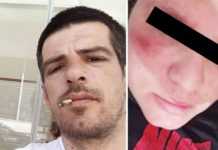 Θύμα άγριου ξυλοδαρμού η μάρτυρας «κλειδί» στο θρίλερ του θανάτου του Κώστα Δασκάλου στην Καβάλα