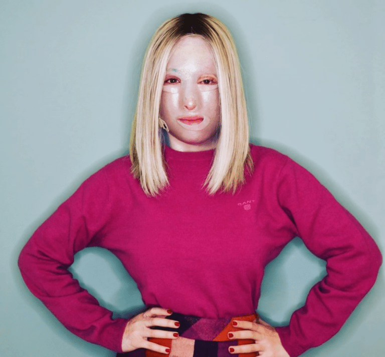 Ιωάννα Παλιοσπύρου: Η πρώτη φωτογραφία από το νέο χειρουργείο που έκανε – Όλες οι λεπτομέρειες