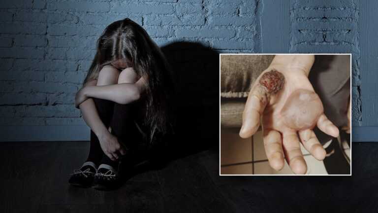 Σπίτι-κολαστήριο στη Νέα Σμύρνη: Πατέρας βασάνιζε και κακοποιούσε σεξουαλικά τη 10χρονη κόρη του