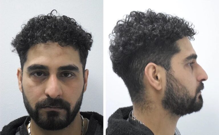 Aυτός είναι ο Ιρακινός που βίασε 11χρονη στην Κατερίνη