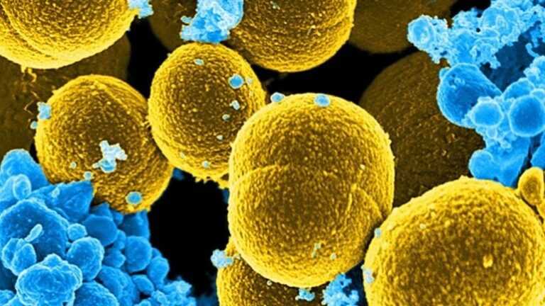 Μεγάλη Βρετανία: Συναγερμός για τον στρεπτόκοκκο Α στα σχολεία – Τέσσερα παιδιά πέθαναν σε ένα μήνα