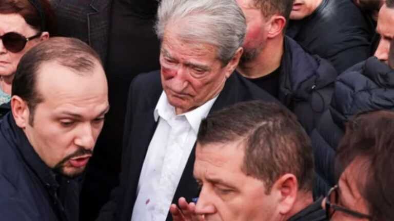 Τίρανα: Άγρια επίθεση στον Σαλί Μπερίσα – Γρονθοκοπήθηκε στο πρόσωπο