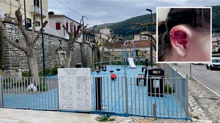 9χρονη έκοψε το αυτί της σε παιδική χαρά – Διακομίστηκε στο Νοσοκομείο «Χατζηκώστα» Ιωαννίνων για την επανασύνδεση του αυτιού