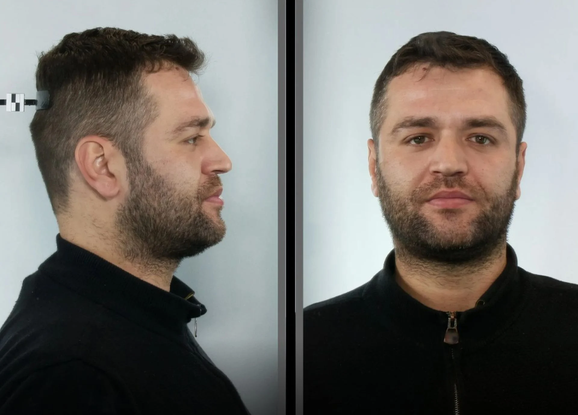 Αυτός είναι ο 36χρονος Αλβανός Κλέφτης Πορτοφολιών – Στη Δημοσιότητα η Φωτογραφία του