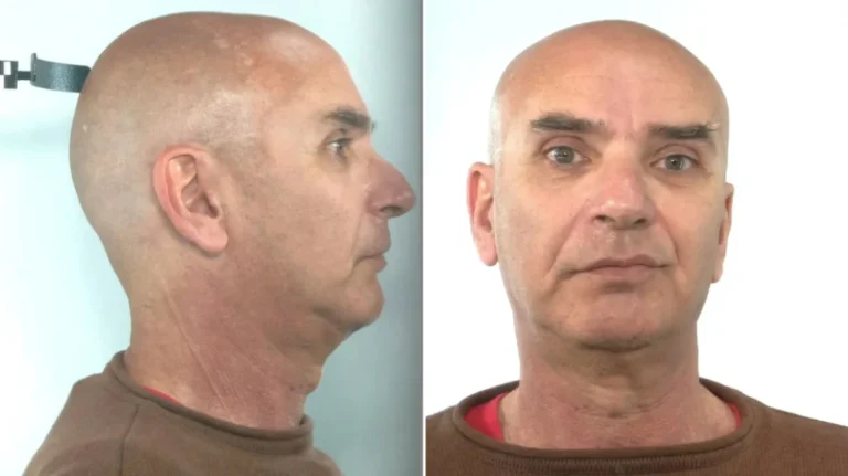 Φρίκη στη Σαλαμίνα: Συνελήφθη εργοθεραπευτής για ασέλγεια σε 17χρονη με βαριά αναπηρία – Υπό διερεύνηση η εμπλοκή του σε περιστατικά με ακόμη δύο ανήλικους