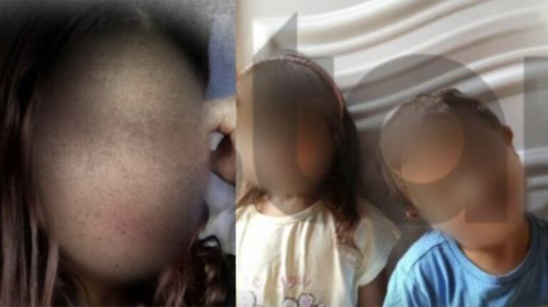 Λάρισα: Δύο παιδιά με σημάδια κακοποίησης από τσιγάρο – Η μητέρα αρνείται κάθε εμπλοκή