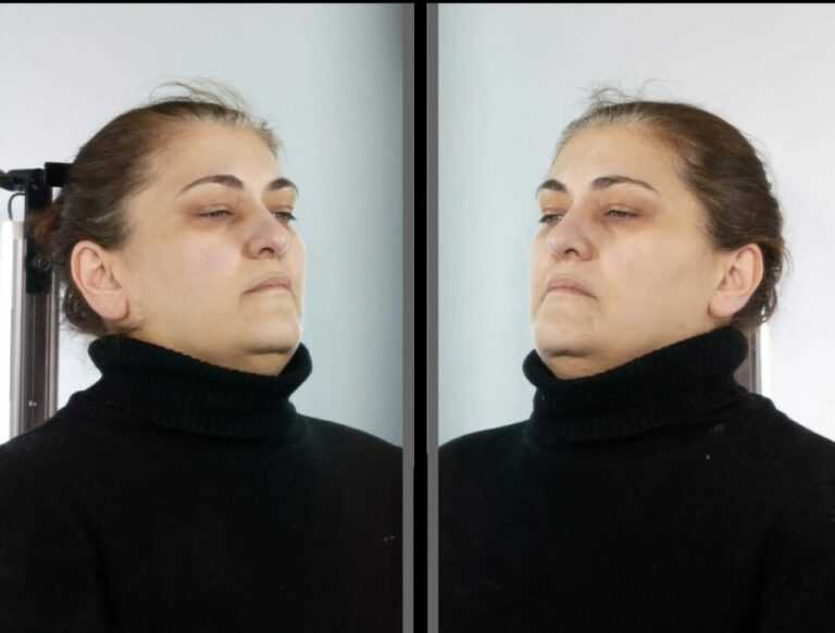 Στη δημοσιότητα το πρόσωπο της «οικιακής βοηθού» που άδειαζε σπίτια – Πώς κέρδιζε την εμπιστοσύνη και έκλεβε τιμαλφή